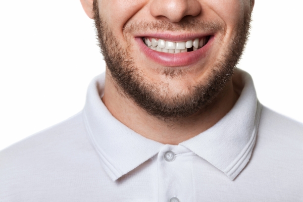tooth loss in houston