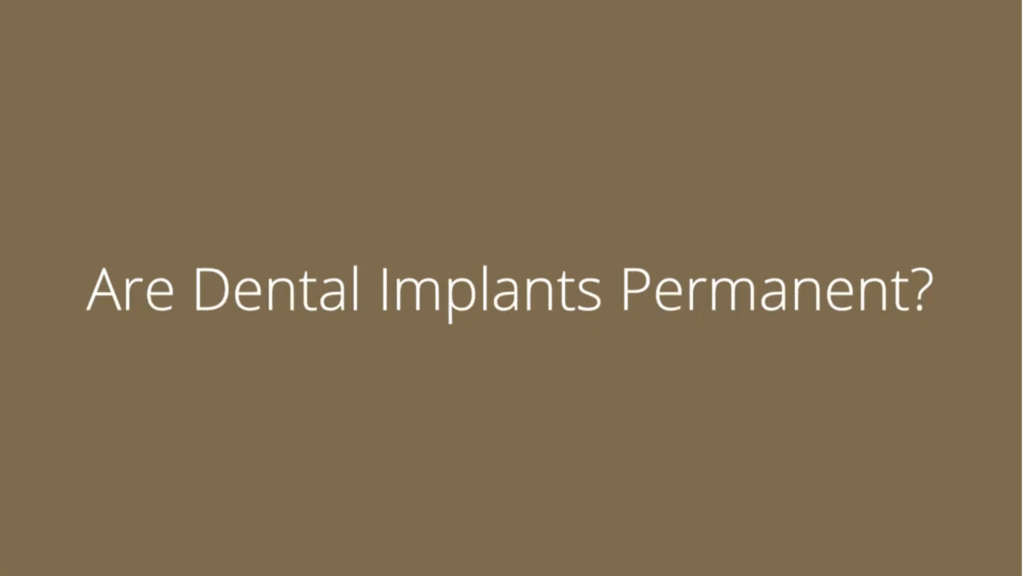 dental implants in Houston