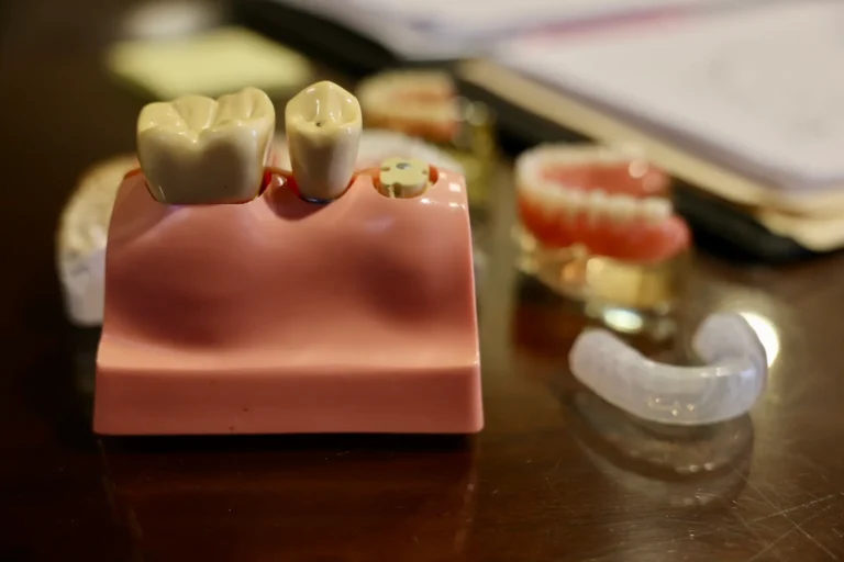 dental implant vs mini implant