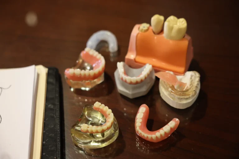 permanent dentures vs dental implants