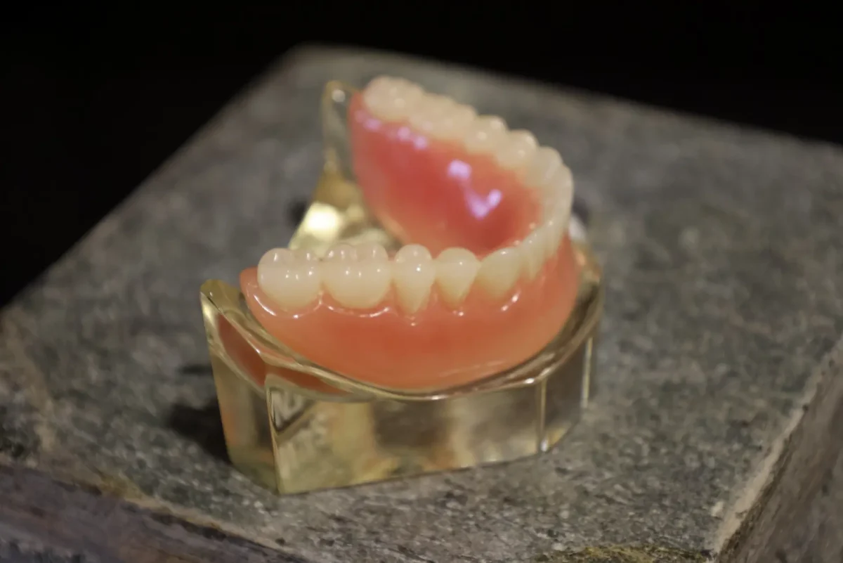 dental implant vs bridge