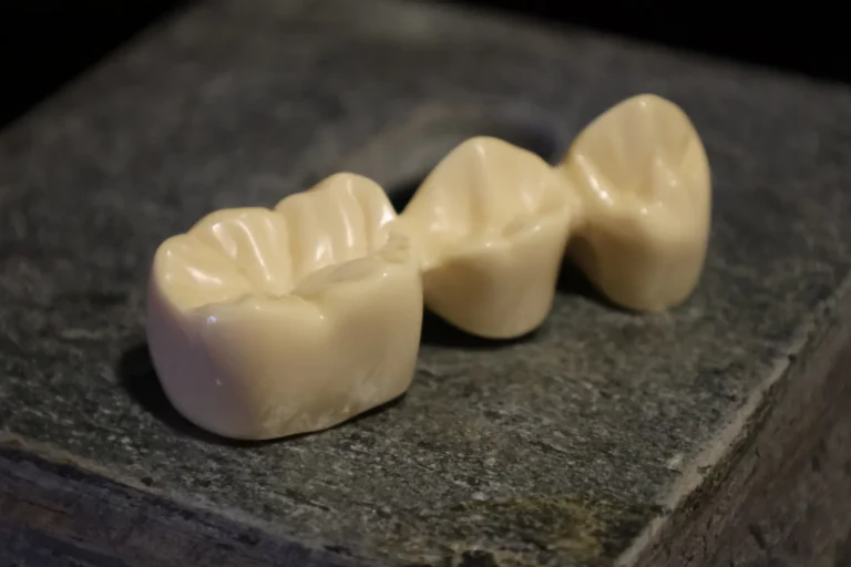 how is a crown attached to a dental implant