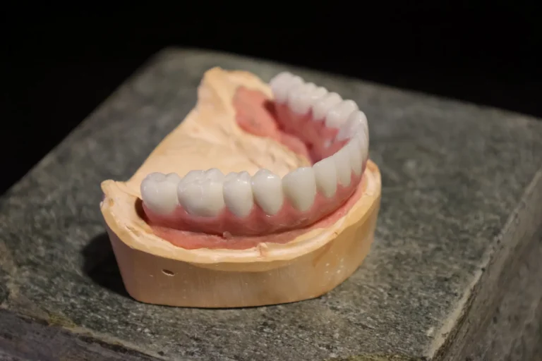 root canal vs dental implant